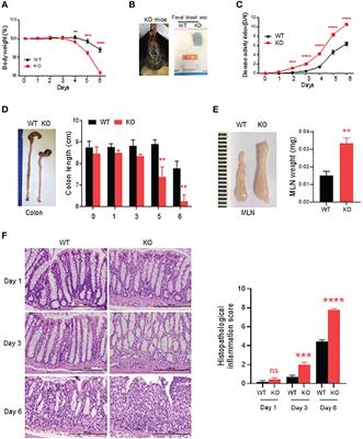 AKR1B8 deficiency drives severe DSS-induced acute colitis through invasion of luminal bacteria and activation of innate immunity